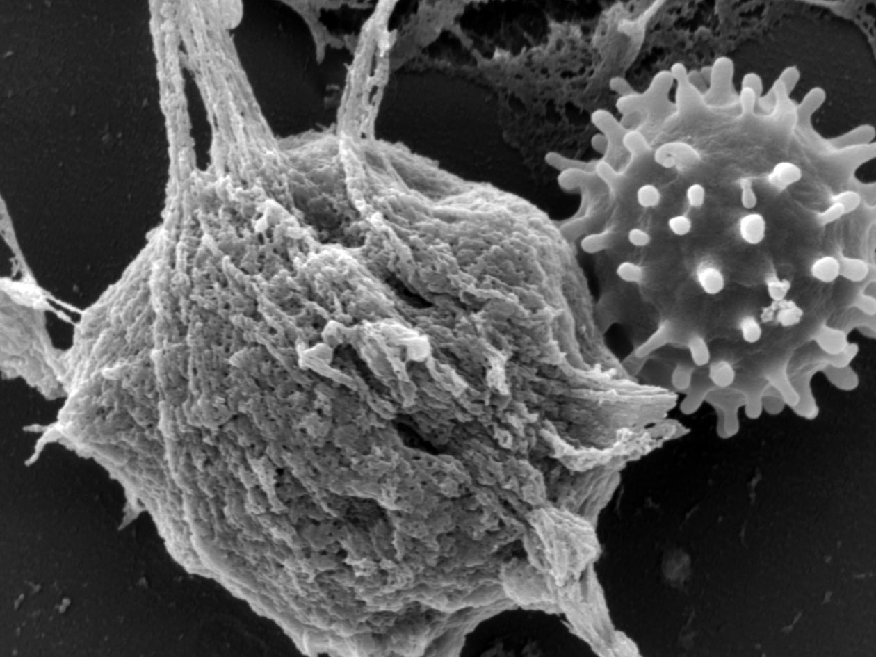 <hr>NETose d’un polynucléaire neutrophile humain stimulé au PMA.