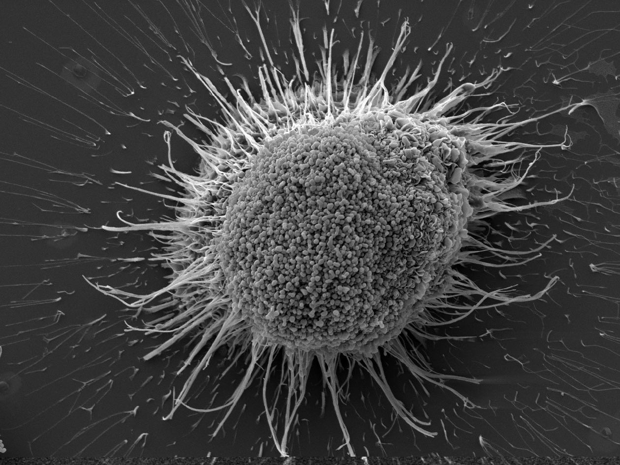<hr>Monocyte humain en cours de différentiation ostéoclastique.