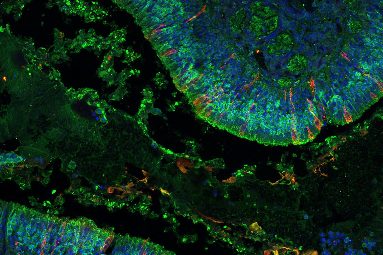 <hr>Localisation du SRAS-CoV-2 dans la cavité nasale. Marquages : rouge SRAS-CoV-2, vert OMP, bleu Hoechst. © B. Bryche, N. Meunier, P. Adenot, MIMA2.