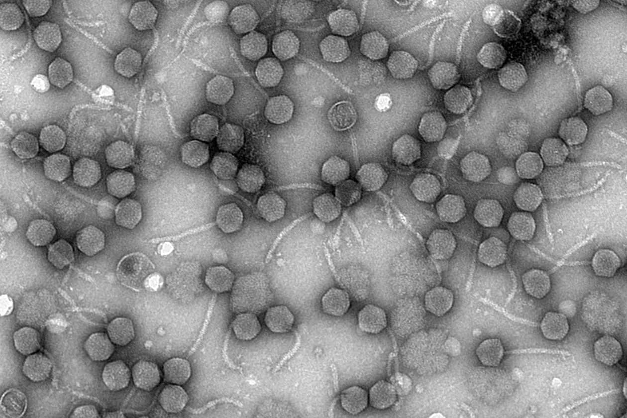 <hr>Bactériophages observés en MET (x 25000). © P. Misson, C. Longin, MIMA2.