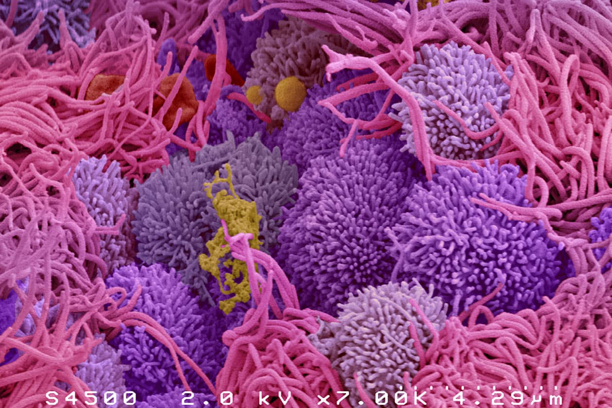<hr>Oviducte canin au stade post-ovulatoire : cellules sécrétrices (petites villosités) et cellules ciliées (grands cils). © K. Reynaud, T. Meylheuc MIMA2.