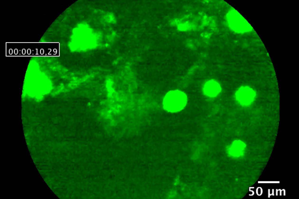 <hr>Microbilles de plastique fluorescentes dans le tube digestif d’une souris observées par Cellvizio. © A. Tarrade, C. Richard, CIMA MIMA2.