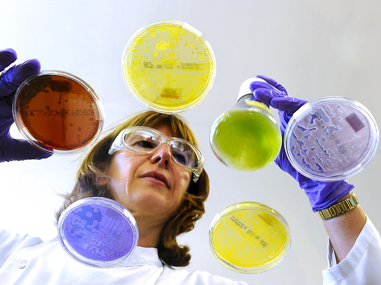 <hr>Analyse visuelle de cultures microbiennes après incubation sur milieux gélosés et de cultures liquides sous hotte à flux laminaire.