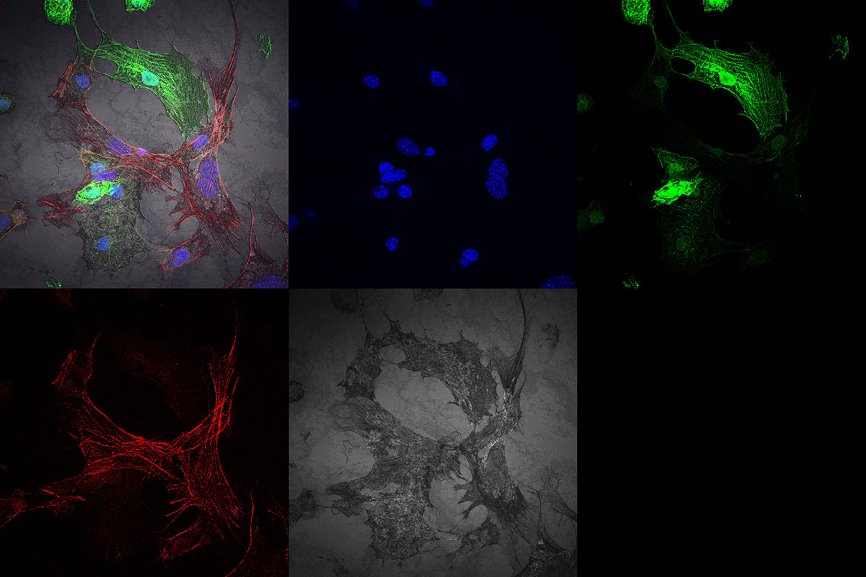 <hr>Cardiomyocytes dérivés de cellules souches IPS (DAPI, Ad GFP, phalloïdine rouge et image en réflexion).