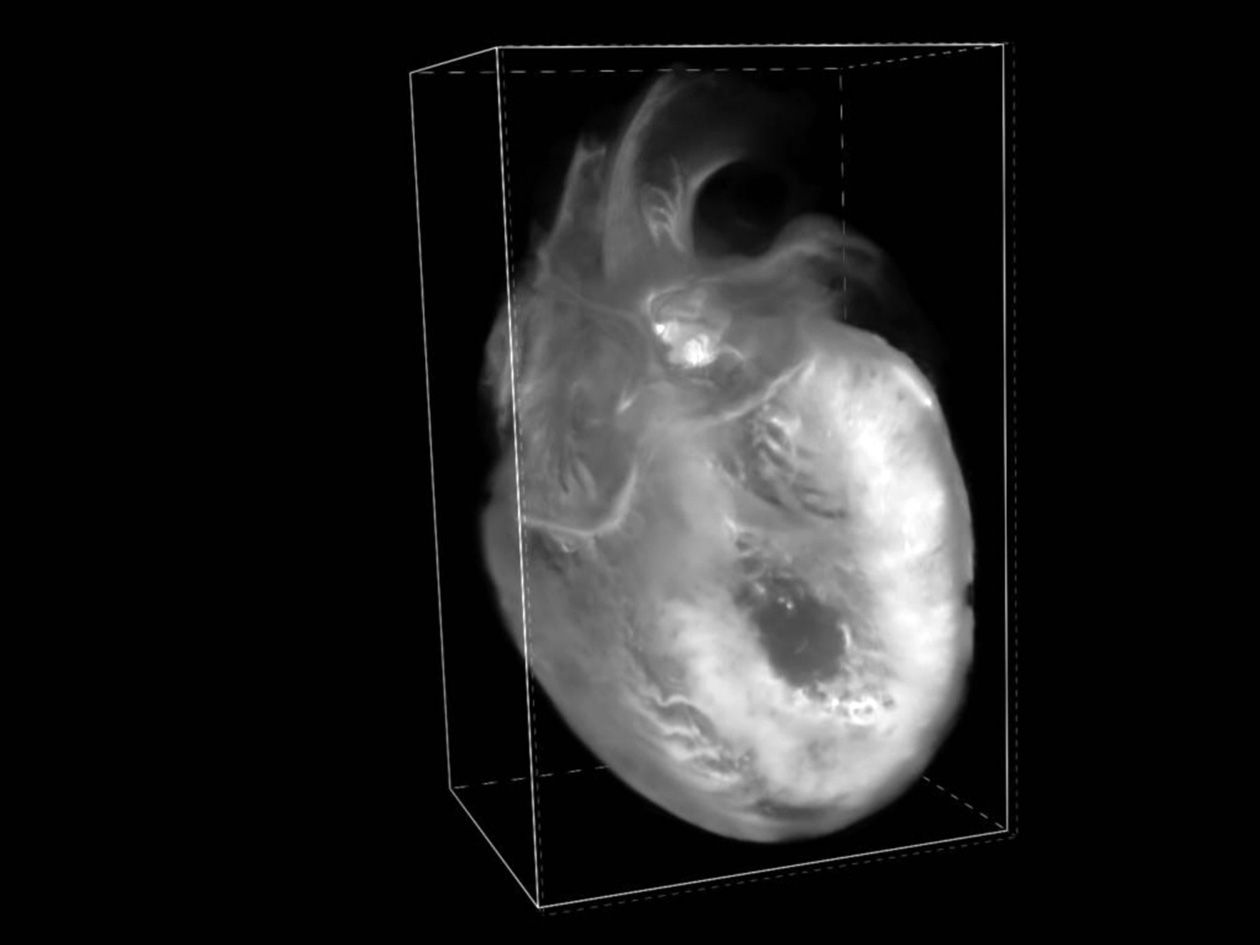<hr>Cœur de souris non marqué visualisé en imagerie épiscopique.