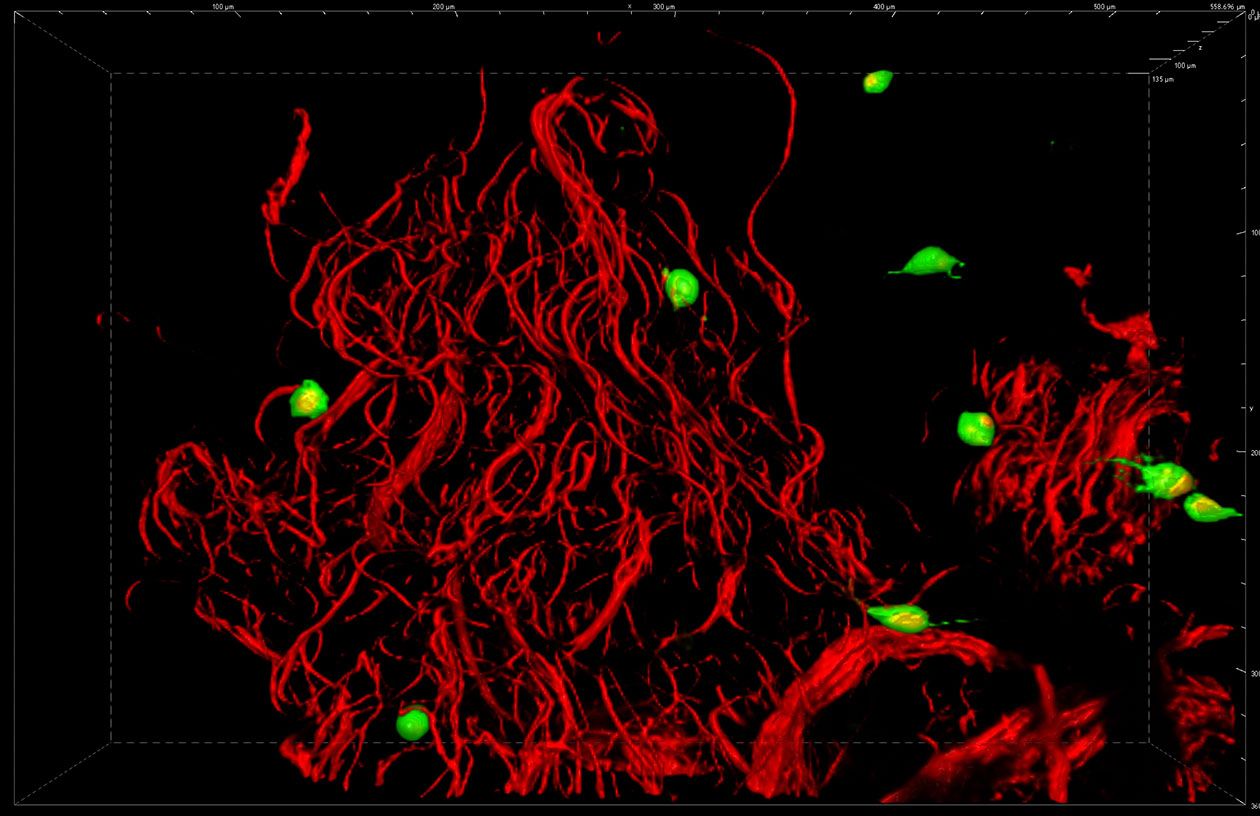 <hr>Fibroblastes sur matrice 3D autofluorescente.