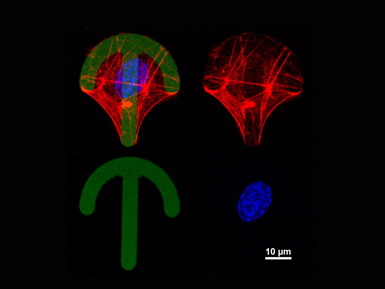 <hr>Cellules endothéliales sur micropattern.