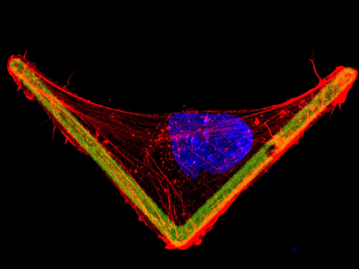 <hr>Marquage de l'actine (phalloïdine, rouge) et du noyau (Hoechst, bleu) de cellule de glioblastome U251 sur micropattern de fibrinogène (vert).