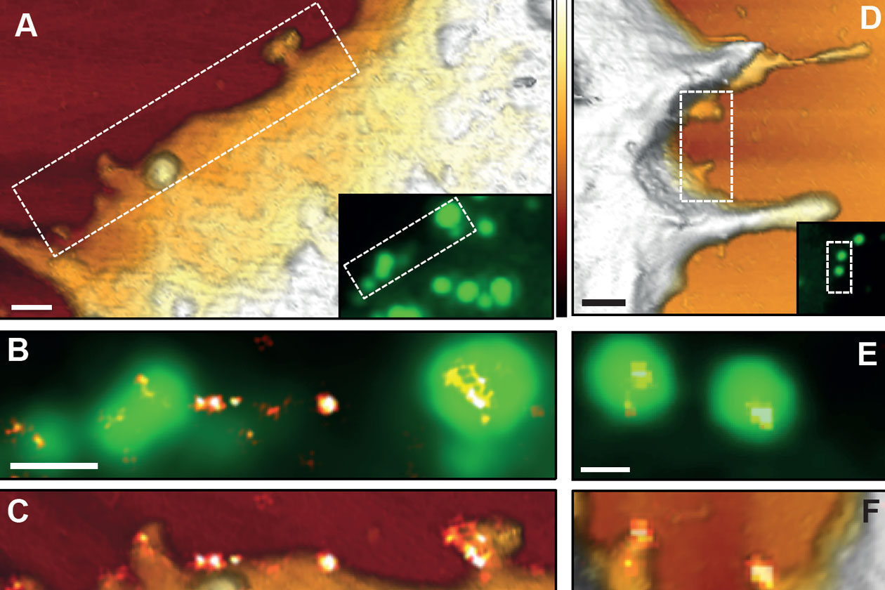<hr>Recrutement de CD9 au niveau des sites de bourgeonnement du virus HIV-1 sur des cellules HeLa imagées par AFM (A et D), fluorescence (B et E) et STORM (C et F).