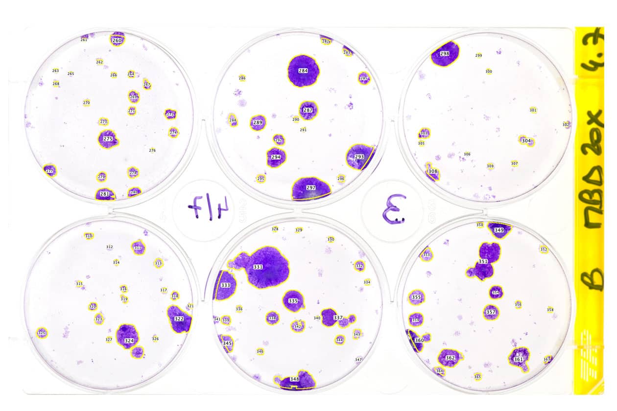<hr>Comptage de colonies bactériennes. © C.N. Gupta (Institut Pasteur), J.-Y. Tinevez (IAH).