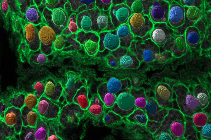 <hr>Identification et segmentation de cellules souches dans le cerveau post-embryonnaire de drosophile. © P. Speder (Institut Pasteur), S. Rigaud (IAH).