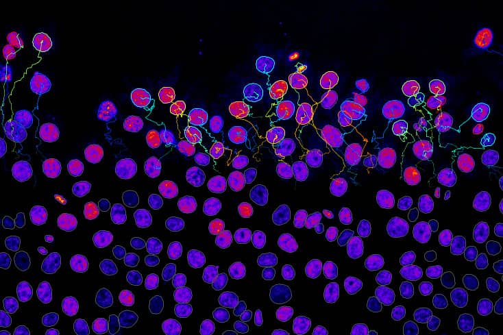 <hr>Migration cellulaire. © G. Jacquemet (Université Abo Akademi), J.-Y. Tinevez (IAH).