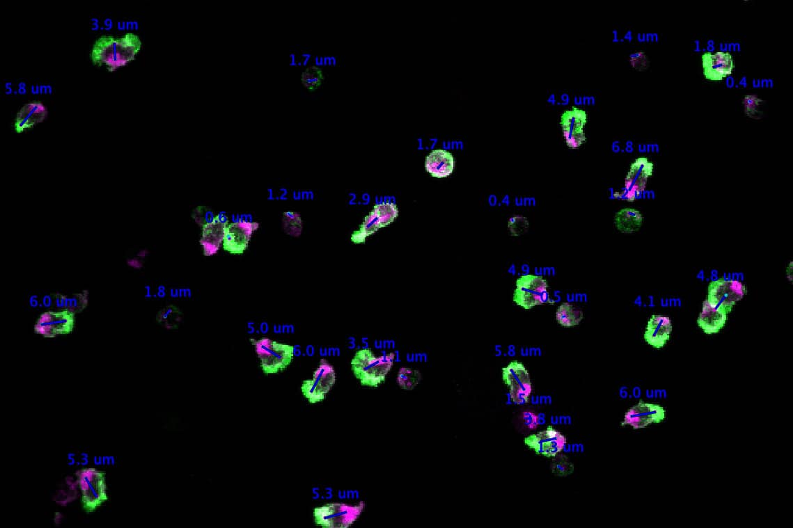 <hr>Mesure de la polarisation de cellules T. © M. Mastrogiovanni (Institut Pasteur), J.-Y. Tinevez (IAH).
