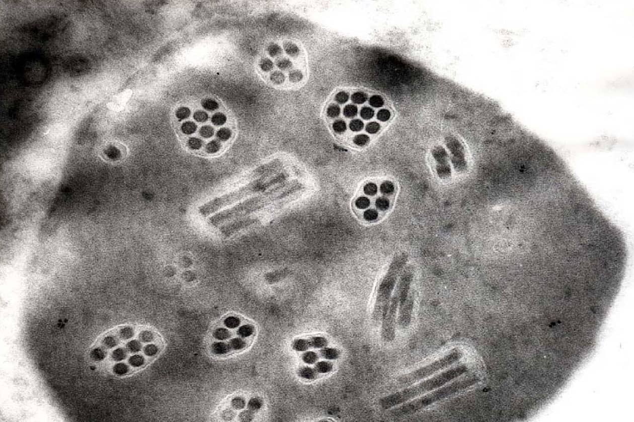<hr>Observation en microscopie électronique d’une coupe de cellule infectée : détail d’un polyèdre avec des particules de baculovirus.