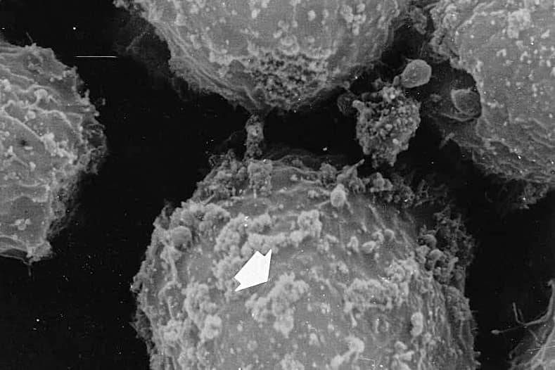 <hr>Observation au microscope de la sécrétion de VLP recombinantes produites grâce au système baculovirus/cellules d’insecte.