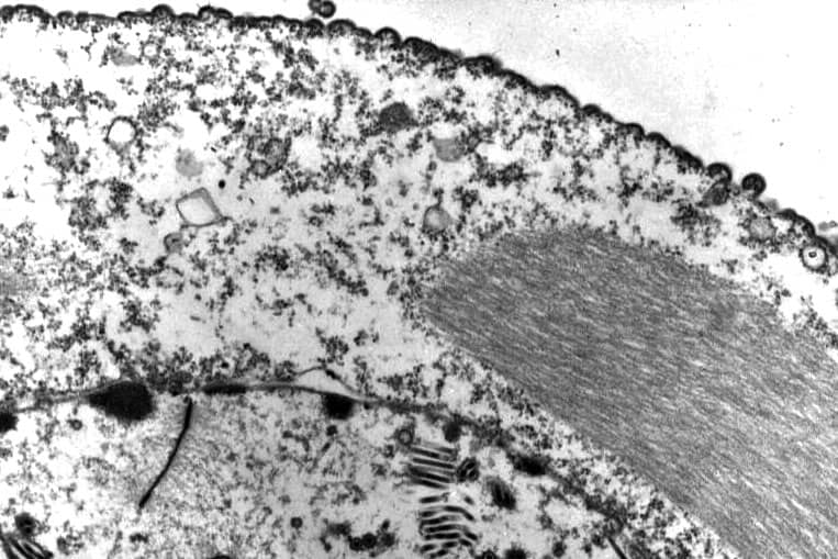 <hr>Reconstruction 3D d’images de microscopie électronique de la sécrétion de VLP recombinantes à la surface de cellules d’insecte.