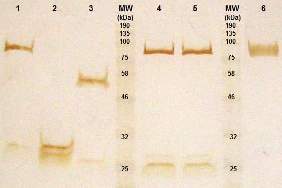 <hr>Analyse en PAGE après purification d’un anticorps bispécifique (1), d’un fragment d’anticorps Fab’2 (2), d’un anticorps IgG3 (3), d’un anticorps bispécifique non concentré (4) et concentré (5) et d’une protéine taguée (6).