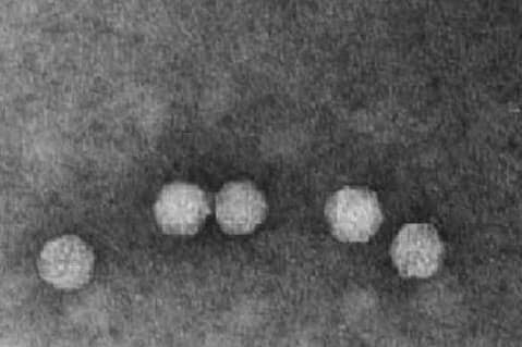 <hr>Observation en microscopie électronique de VLP recombinantes sécrétées par des cellules infectées par un virus recombinant.