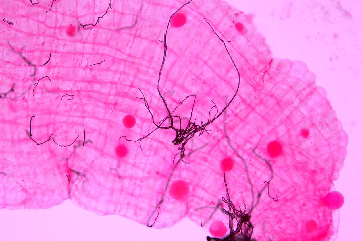 <hr>Premier intestin d’anophèle de la plateforme infecté avec des oocystes de P. falciparum. Coloration à l’éosine. © S. Blandin.