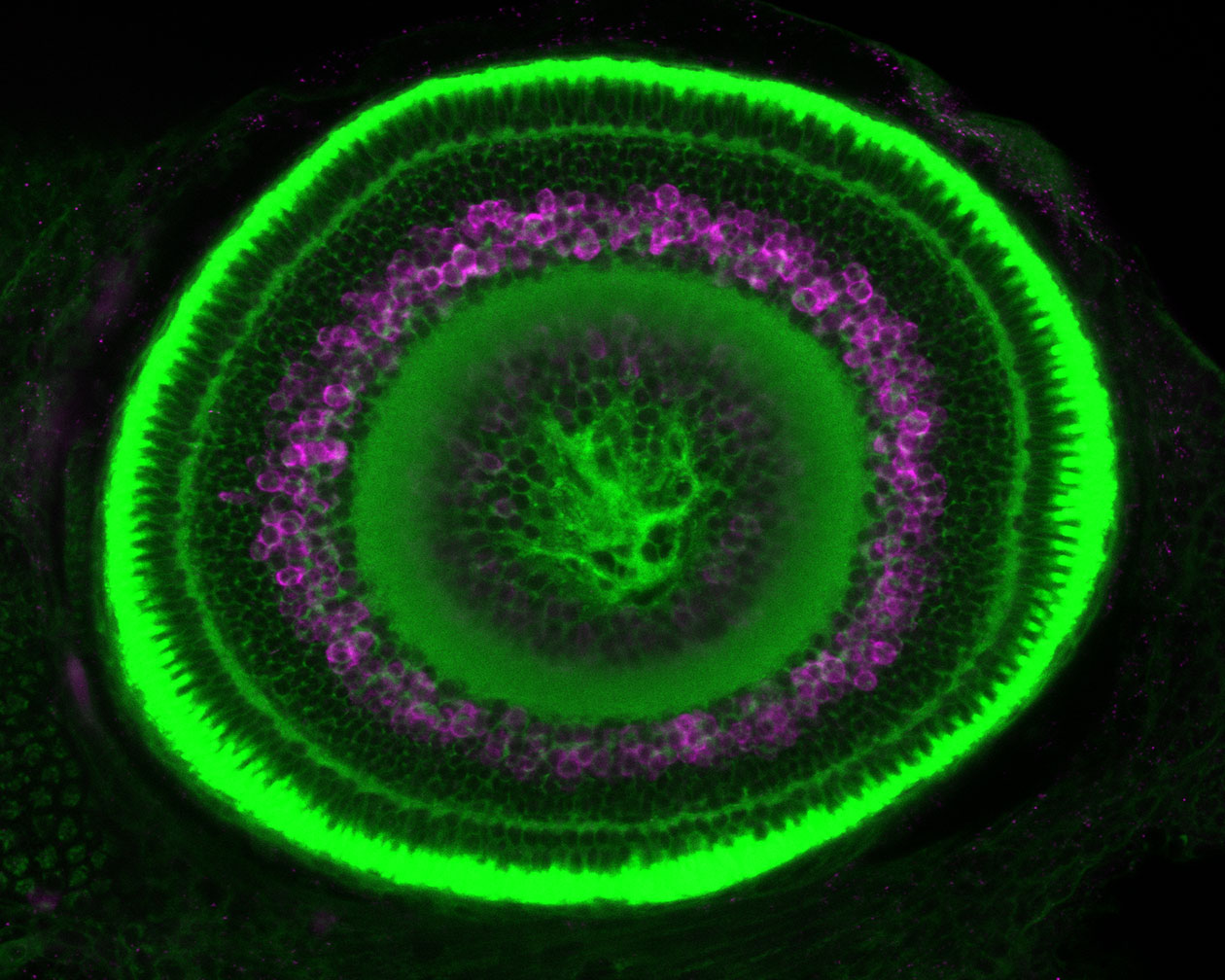 <hr>Oeil de poisson zèbre : neurones en magenta et lipides en vert.