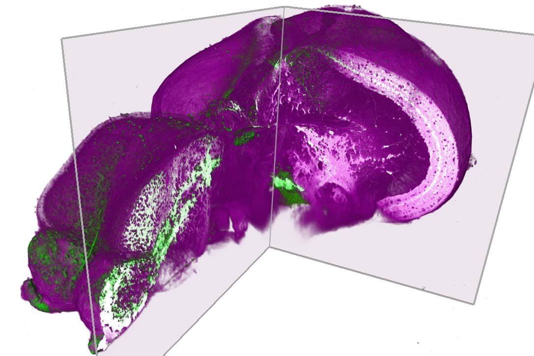 <hr>Cerveau de poisson zèbre juvénile après marquage lipidique magenta et marquage GFP vert.