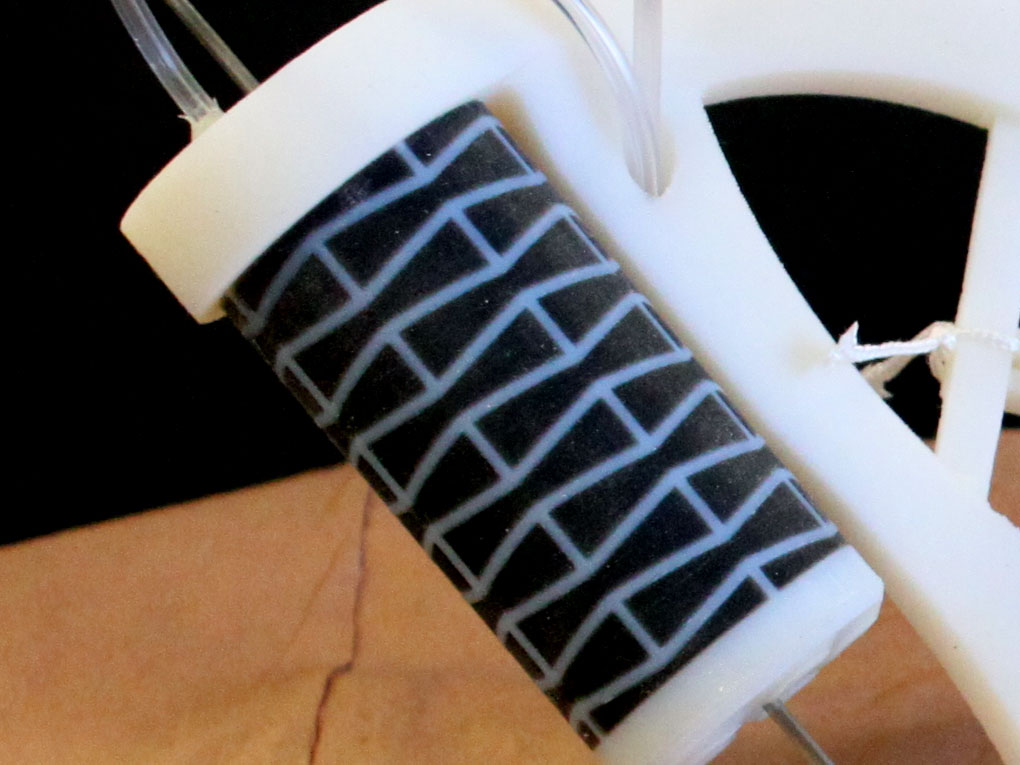 <hr>Actionneur linéaire pneumatique compatible IRM avec structure auxétique pour l’insertion d’une aiguille.