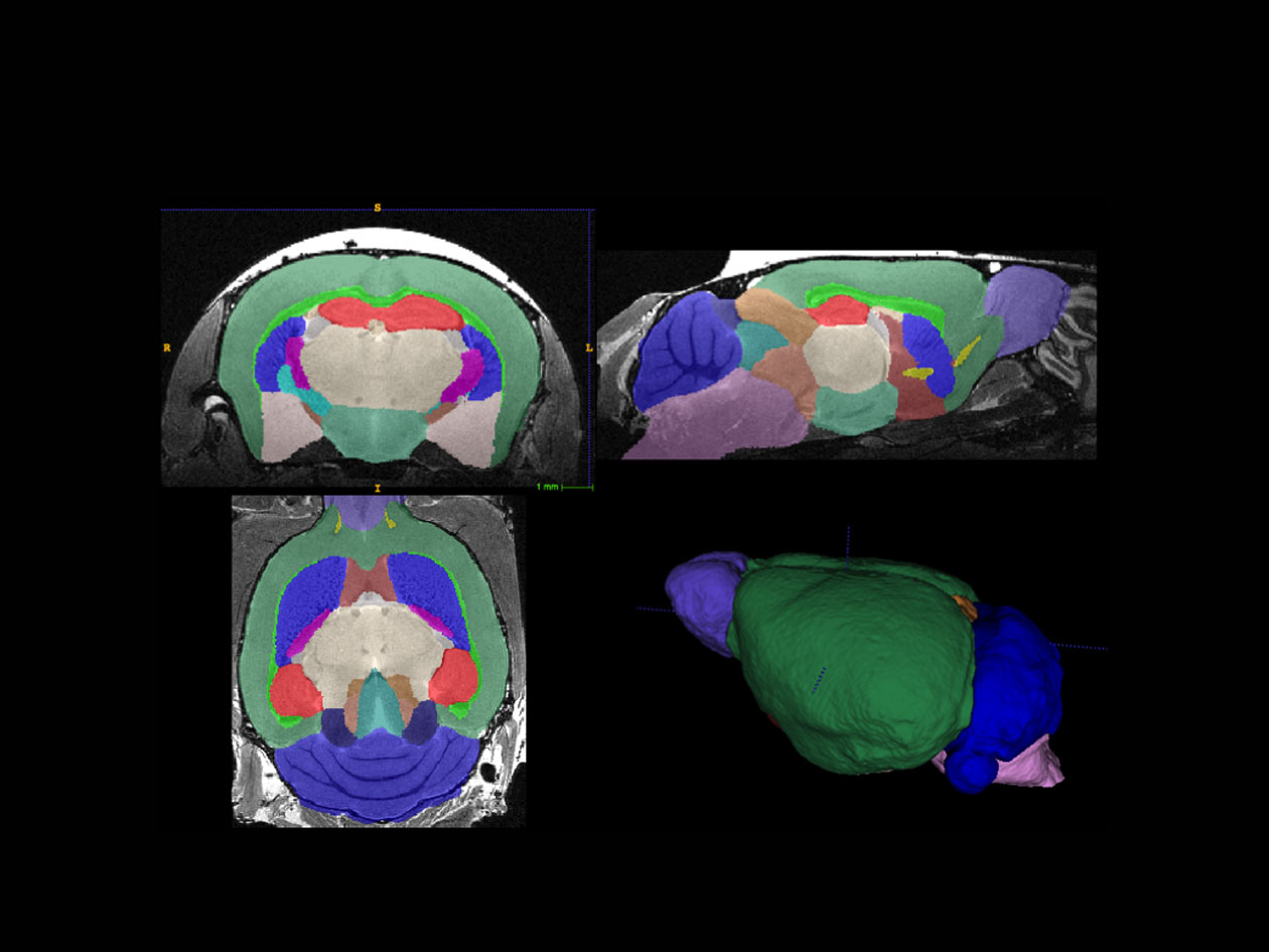 <hr>Segmentation des structures anatomiques cérébrales chez la souris.