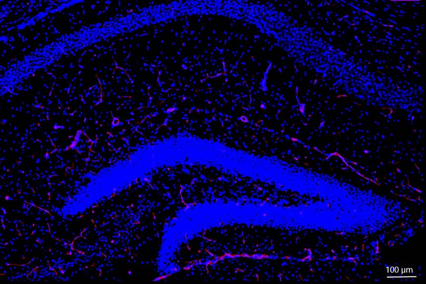 <hr>Vascularisation de l’hippocampe (marquage CD31 en rouge) sur une coupe transversale de cerveau de souris. © IRSN.