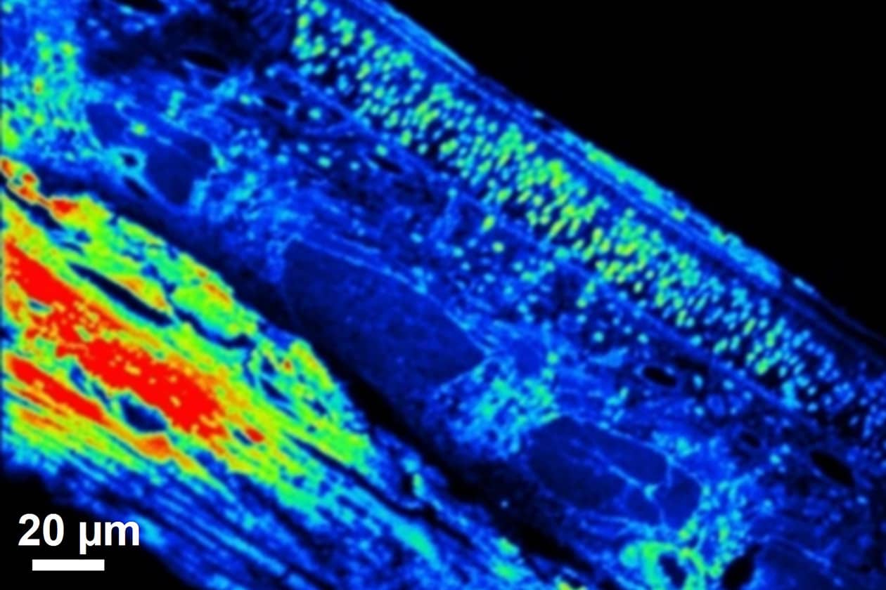 <hr>Image ionique SIMS du calcium-40 au sein d'un épithélium olfactif de rongeur. © IRSN.