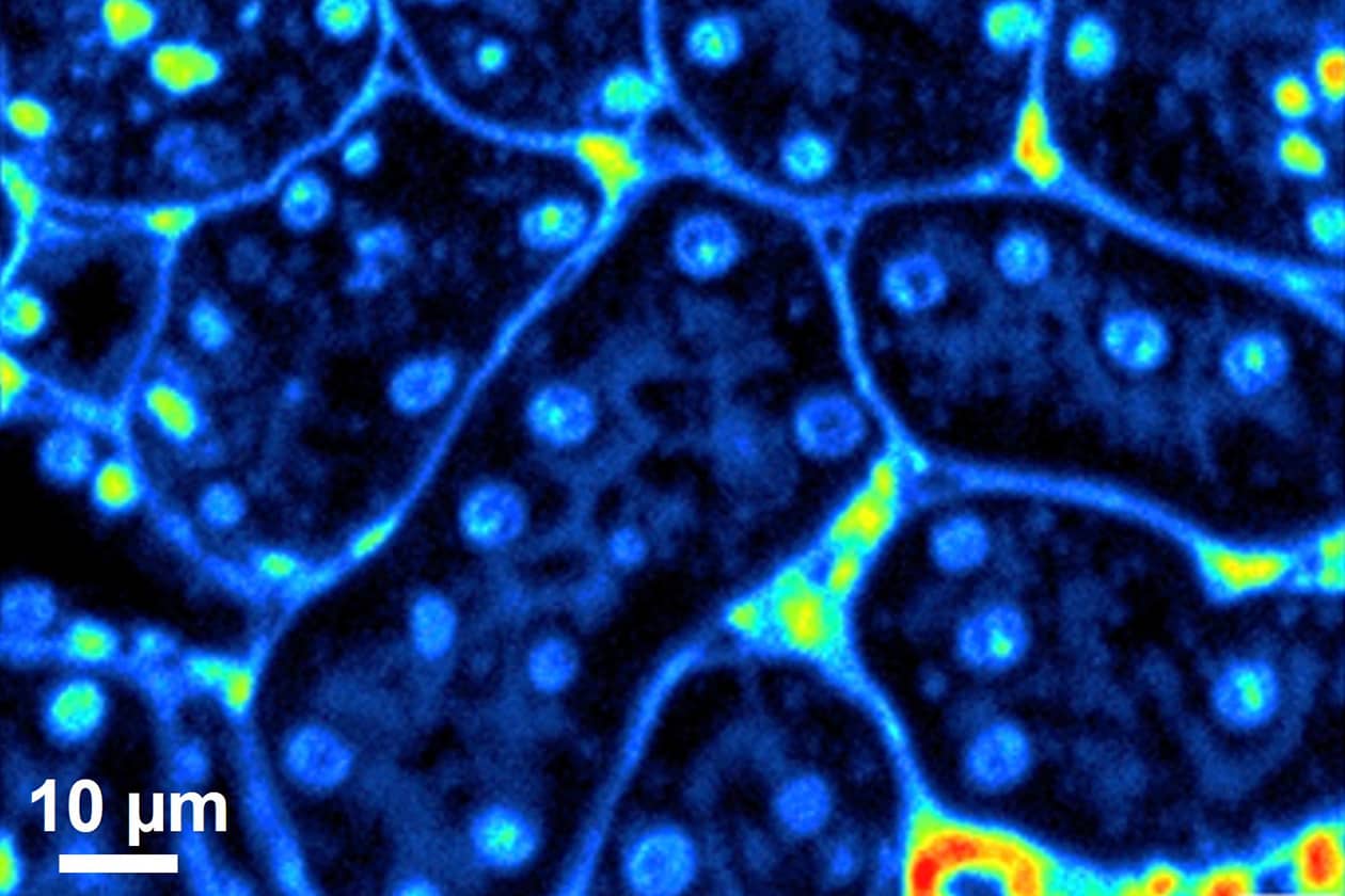 <hr>Image ionique SIMS du calcium-40 au sein d'une structure rénale de rongeur. © IRSN.