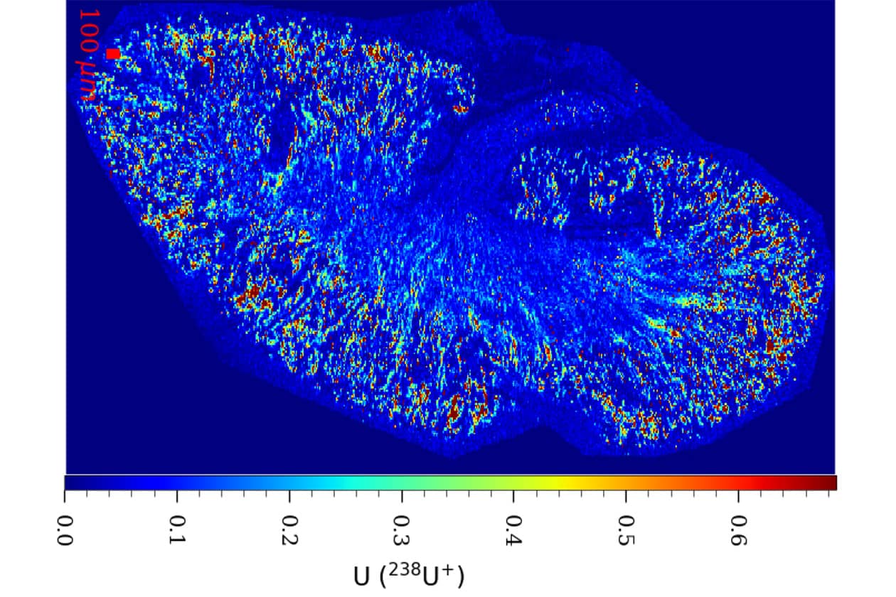 <hr>Analyse de l’uranium dans un tissu rénal de rongeur par ablation laser couplée à l’ICP-MS (projet UKCAN). © IRSN.