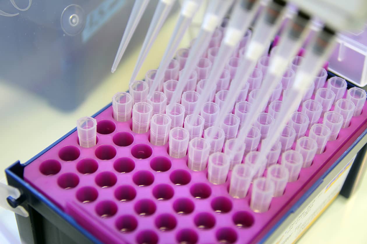 <hr>Cônes à filtres et pipette multicanaux.