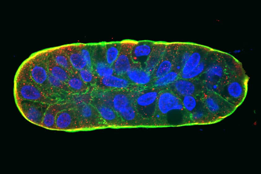 <hr>Cellules cancéreuses migrant dans des microcanaux non adhérents. Phalloïdine (vert), myosine (rouge), noyaux (bleu). © D. Pages.
