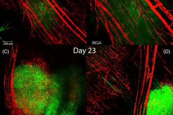 <hr>Imagerie intravitale en chambre dorsale d’une tumeur 4T1 (GFP) et du réseau vasculaire (Dextran-TRITC) à deux stades d’évolution.