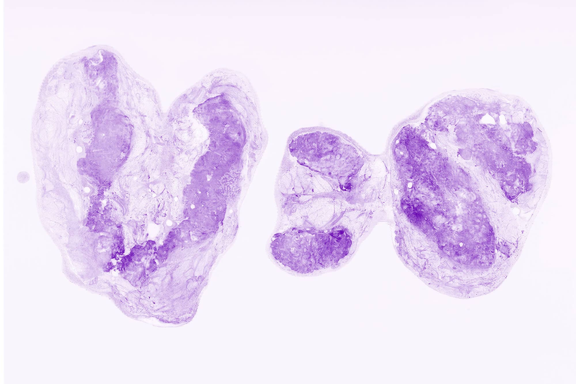 <hr>Ganglions ORL humains imagés ex vivo avec un Histolog-scanner.