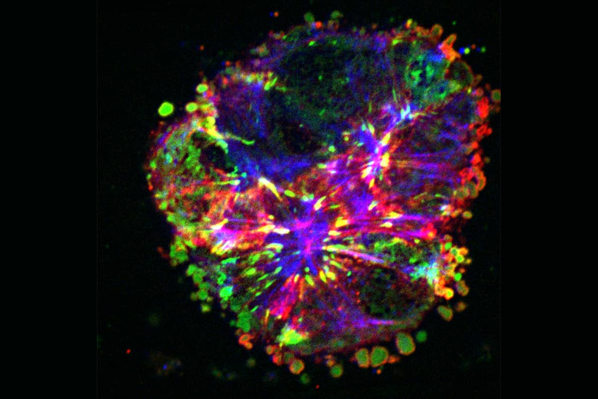 <hr>Amas de cellules cancéreuses HT29-MTX migrant dans un microcanal confiné et non adhésif. Actine (rouge), MLC (bleu), vinculine (vert). © E. Dornier.