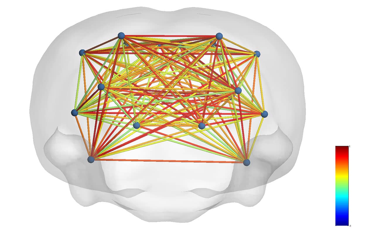 <hr>Étude de connectivité fonctionnelle chez le rat témoin.