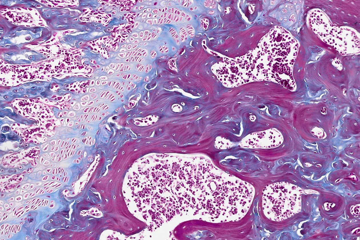<hr>Fémur de souris coloré au trichrome de Masson.