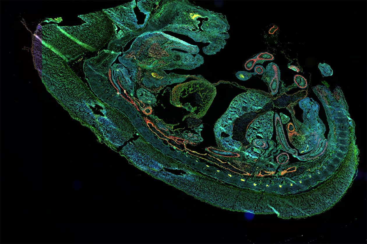 <hr>Technique d’immunofluorescence sur un embryon de souris.