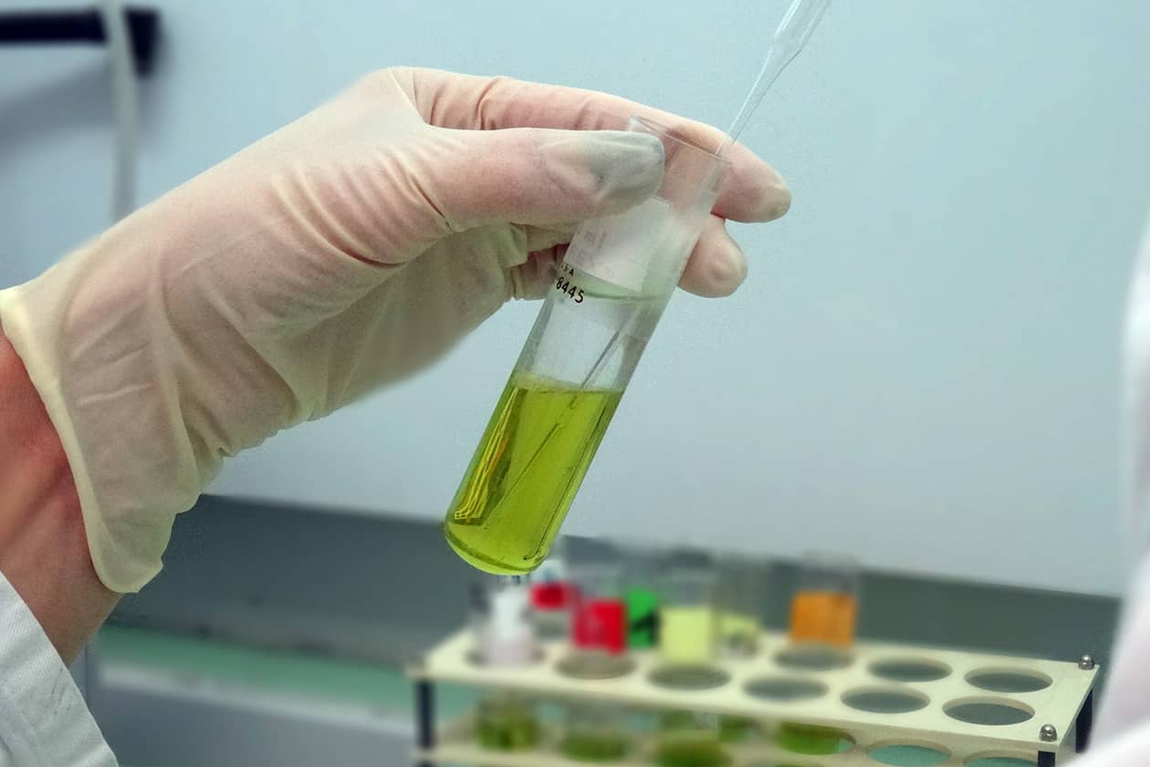<hr>Extraction de lipides.