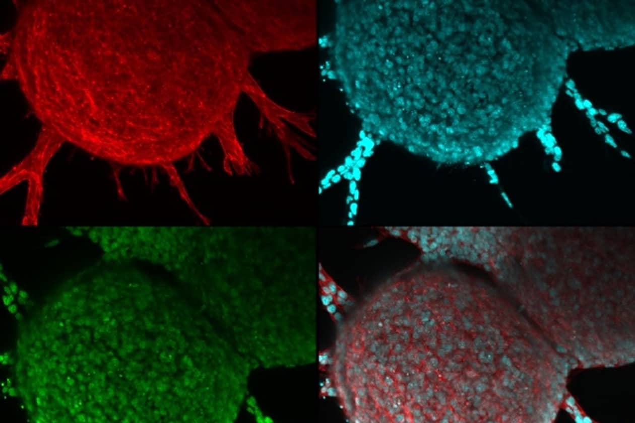 <hr>Image confocale d’un sphéroïde unicellulaire de carcinome épidermoïde dans une matrice extracellulaire.