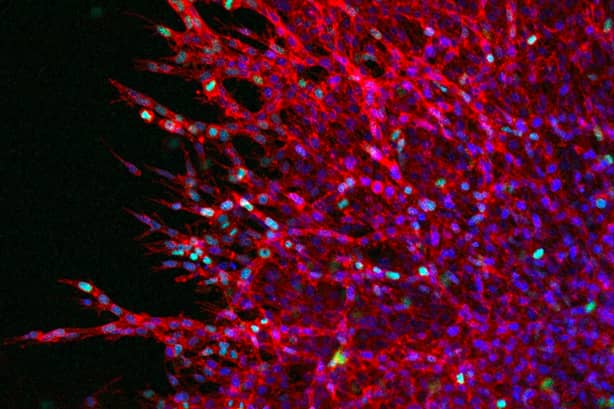 <hr>Image confocale d’un sphéroïde unicellulaire de carcinome épidermoïde dans une matrice extracellulaire.