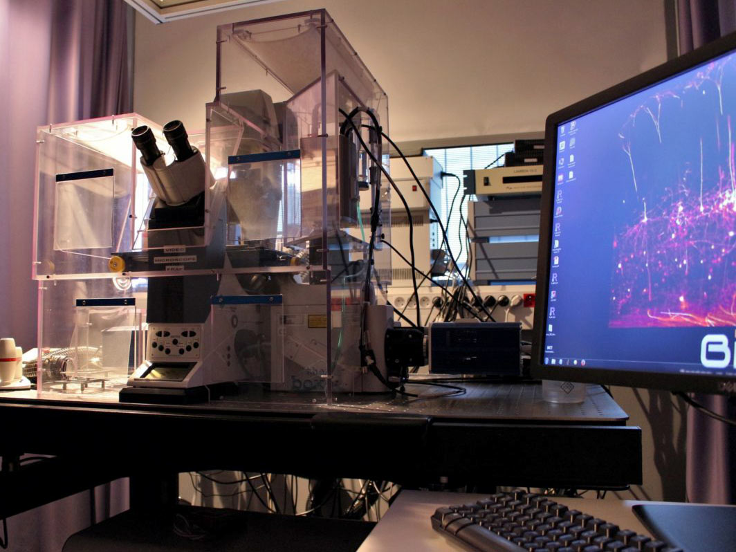 <hr>Microscope spinning disk DMI6000B équipé de FRAP (Leica).