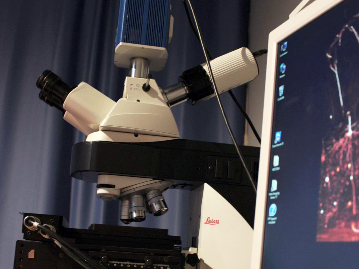 <hr>Microscope plein champ DM5000 (Leica).