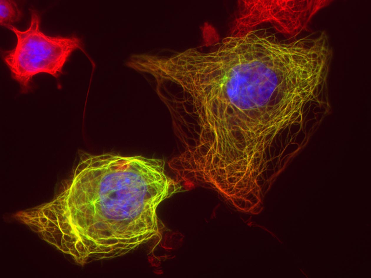<hr>Cytosquelette observé en microscopie plein champ. © IMAG’IC, L. Ghouinem.