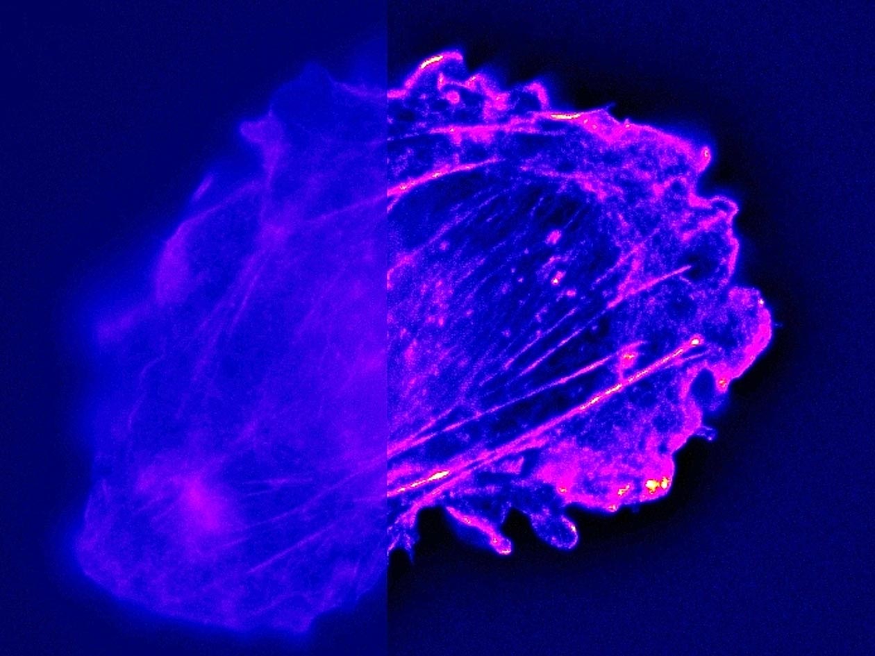 <hr>Microscopie plein champ avec déconvolution. © IMAG'IC, Cochin Image Database.