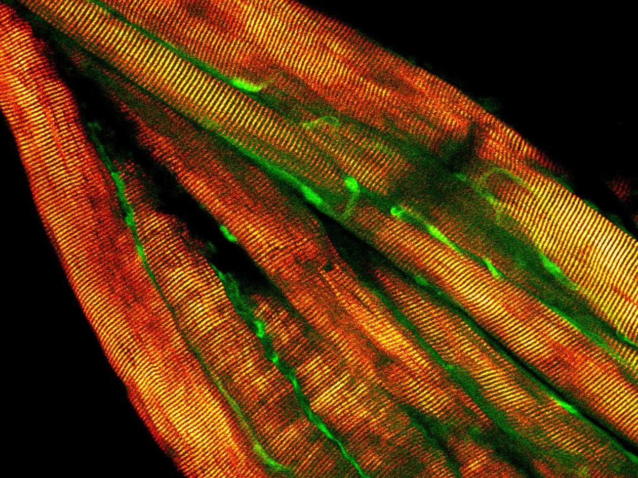 <hr>Muscle observé en microscopie multi-photonique et SHG © IMAG’IC, P. Maire, T. Guilbert.