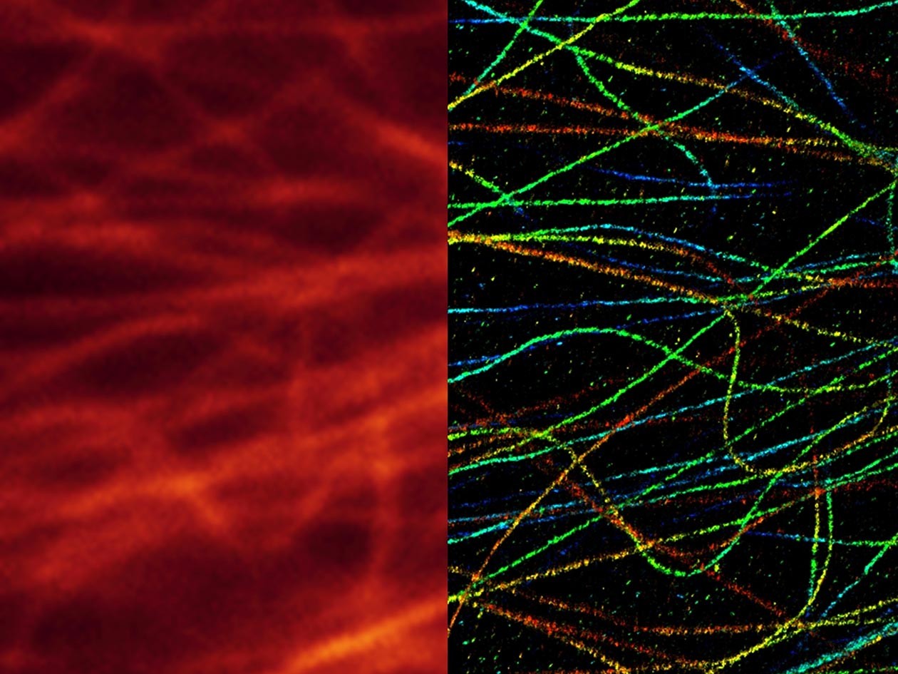 <hr>Microtubules observés en microscopie super-résolution dSTORM 3D. © IMAG’IC, B. Durel.