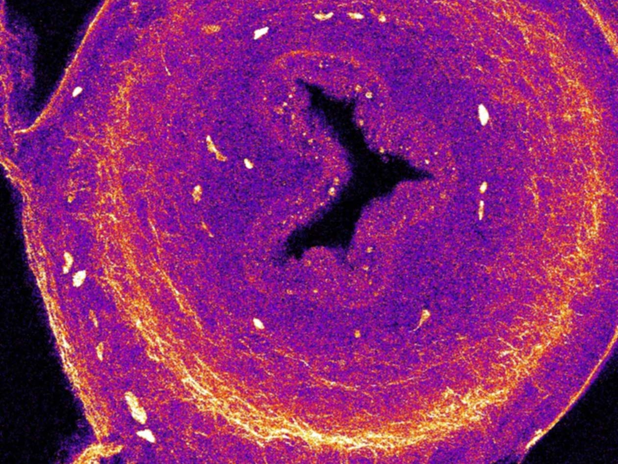 <hr>Intestin observé en microscopie multi-photonique et SHG © IMAG’IC, T. Guilbert, MISC, N. Chevalier.