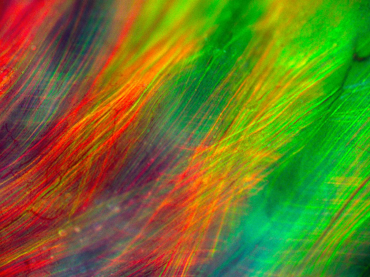<hr>Fibre musculaire observée en microscopie plein champ. © IMAG’IC, M. Dos-Santos.